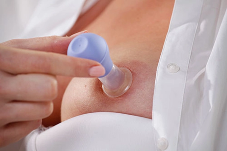 Delikatne i szybkie uformowanie brodawki